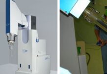 Tumore al seno, svolta a Foligno: asportazione e radioterapia vengono fatte contestualmente